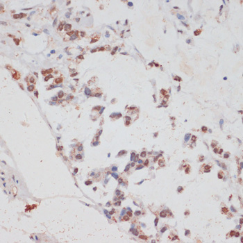 HTATSF1 antibody