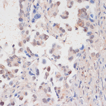 HTATSF1 antibody