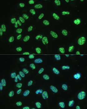 ALYREF antibody