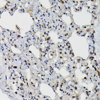 PRPF4 antibody