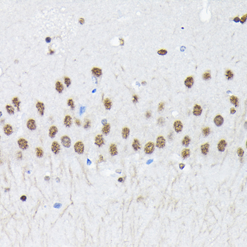 PTBP2 antibody