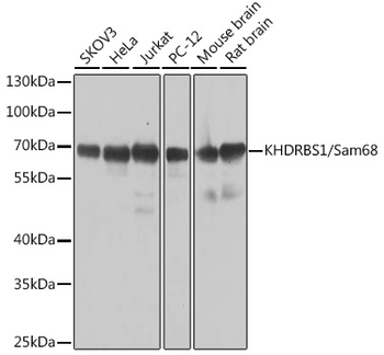 KHDRBS1 antibody