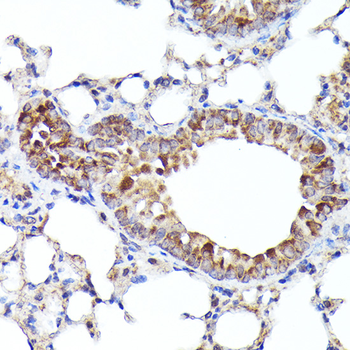 BNIP3L antibody