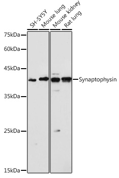 SYP antibody