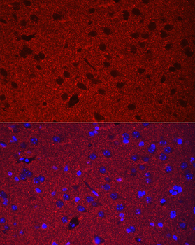 SYP antibody