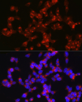 SYP antibody