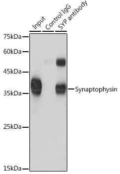 SYP antibody