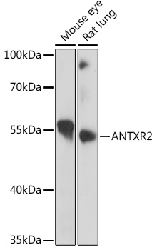 ANTXR2 antibody