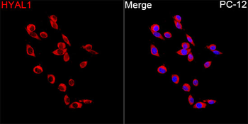 HYAL1 antibody