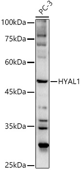 HYAL1 antibody