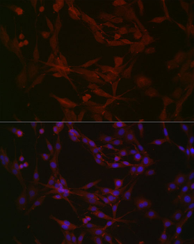 NPHP1 antibody