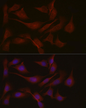 NPHP1 antibody