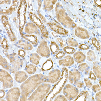 NPHP1 antibody