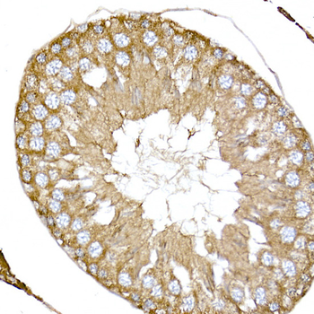 NPHP1 antibody