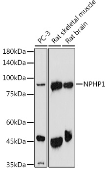 NPHP1 antibody