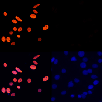 Acetyl-Histone H3-K27 antibody