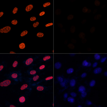 Acetyl-Histone H3-K27 antibody