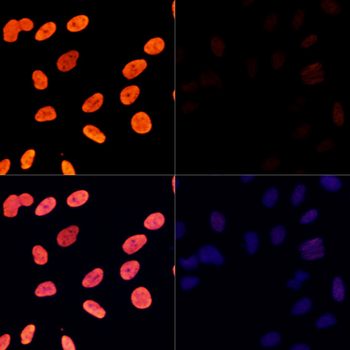 Acetyl-Histone H3-K27 antibody