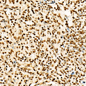 Acetyl-Histone H3-K27 antibody