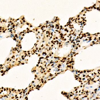 Acetyl-Histone H3-K27 antibody