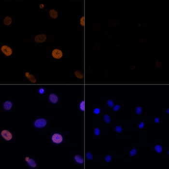 Acetyl-Histone H3-K56 antibody