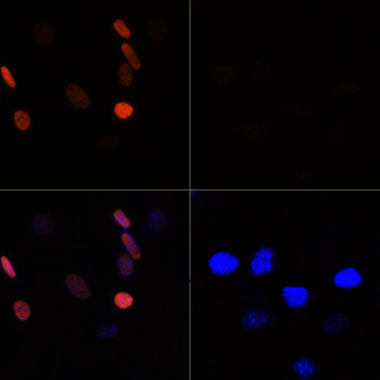 Acetyl-Histone H3-K56 antibody