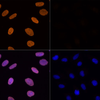 Acetyl-Histone H3-K56 antibody