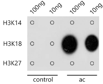 Acetyl-Histone H3-K18 antibody