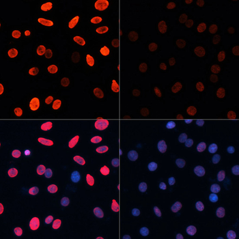 Acetyl-Histone H3-K18 antibody