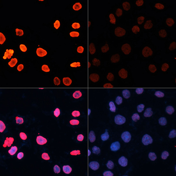 Acetyl-Histone H3-K18 antibody