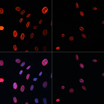 Acetyl-Histone H3-K18 antibody