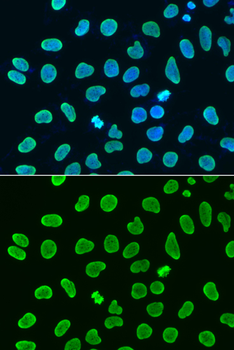 Acetyl-Histone H4-K8 antibody