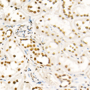 Acetyl-Histone H4-K8 antibody