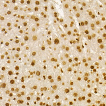 Acetyl-Histone H4-K8 antibody