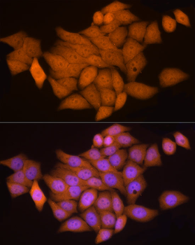 NOTCH1 antibody