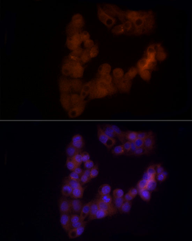 NOTCH1 antibody