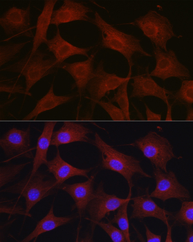 NOTCH1 antibody