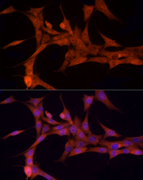 NOTCH1 antibody