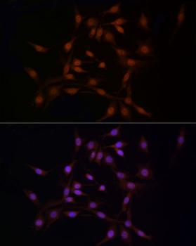 NOTCH1 antibody