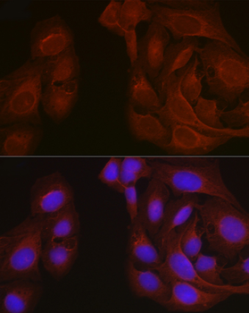 NOTCH1 antibody