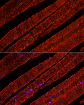 SLC2A4 antibody