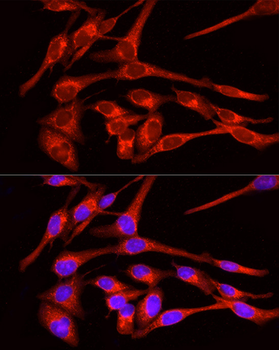 SLC2A4 antibody