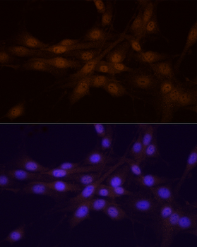 CHEK1 antibody