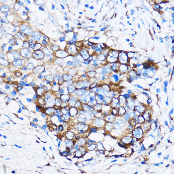 CHEK1 antibody