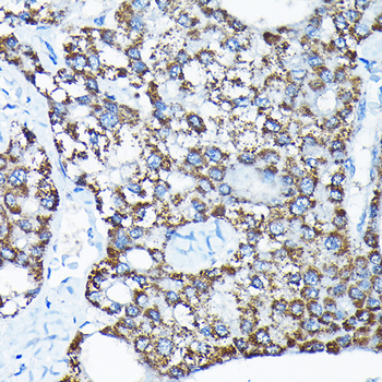 ETFA antibody