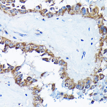 ETFA antibody