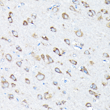 ETFA antibody