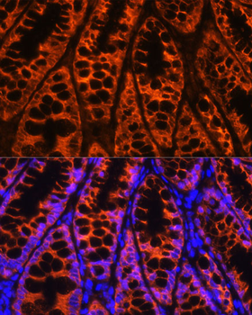 YBX1 antibody