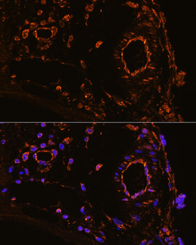 YBX1 antibody