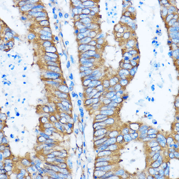 YBX1 antibody